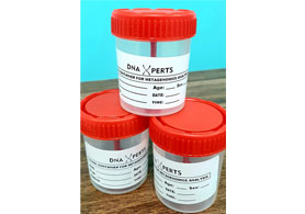 Metagenomics Stool Stabiliser Kit